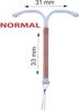 IUD SMB TCu Ag Nova T Type With Copper And Silver ORDER WITH BIG DISCOUNT Look Here T