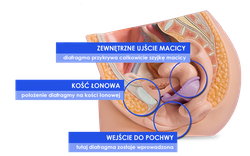 ZESTAW Diafragma Caya® + Caya® Gel w SUPER CENIE